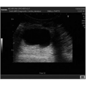 کاهش نویز Speckle در تصاویر سونوگرافی در MATLAB