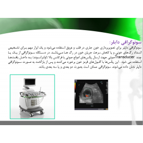پاورپوینت آماده اثر سونوگرافی داپلر در تشخیص گرفتگی عروق